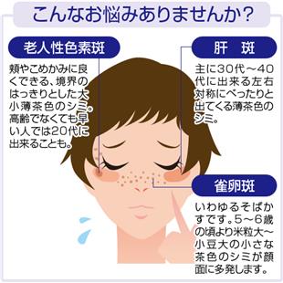 スーパーパールホワイト(1シート)