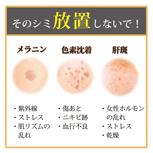本気のシミケア!集中美白クリーム